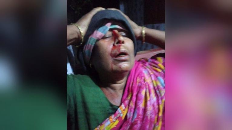 সালথায় সম্পত্তি নিয়ে মাকে পিটিয়ে রক্তাক্ত করল সন্তানরা