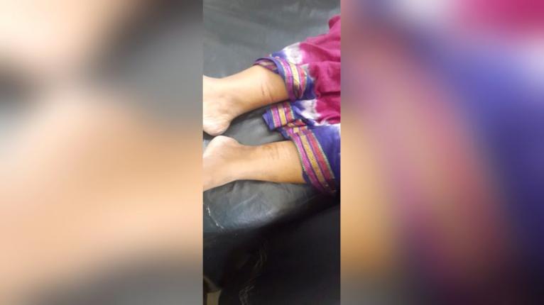 বোয়ালখালীতে দুুর্বৃত্তরা ৩ ঘন্টা তান্ডবে এক নারী আহত