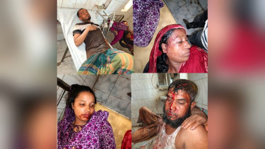 লালমোহনে জমিজমা সংক্রান্ত সালিশে রক্তক্ষয়ী সংঘর্ষ, নারী-শিশুসহ একাধিক আহত