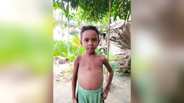 আড়াই লাখ টাকার অভাবে থমকে আছে শিশু মিনহাজের চিকিৎসা