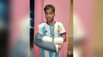 লালমোহনে কলেজ ছাত্রের দুই হাত ভেঙ্গে দিলো কিশোর গ্যাং