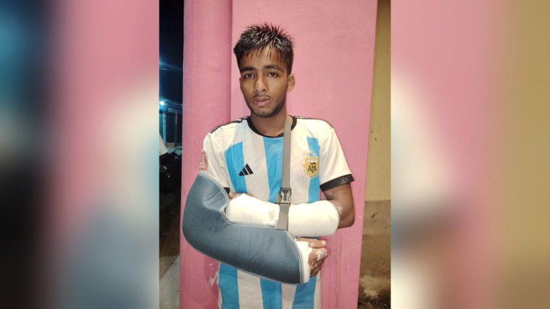 লালমোহনে কলেজ ছাত্রের দুই হাত ভেঙ্গে দিলো কিশোর গ্যাং